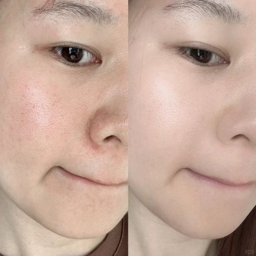 行第一名 2025爆款品牌挑选攻略！开元棋牌什么护肤品最好用？护肤产品排(图9)